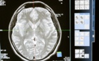 Une étude européenne se penche sur les raisons du vieillissement du cerveau