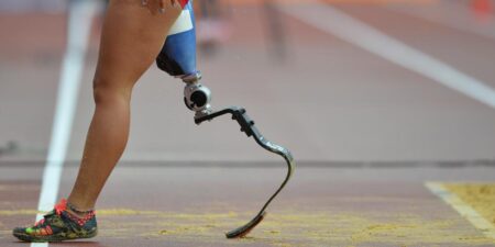 Human Lab, le "laboratoire" qui fabrique des prothèses bon marché