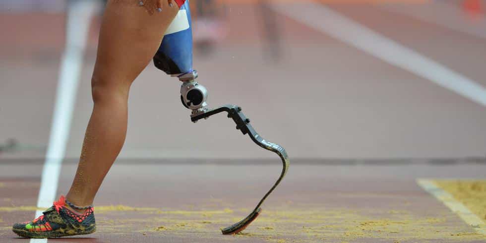 Human Lab, le "laboratoire" qui fabrique des prothèses bon marché