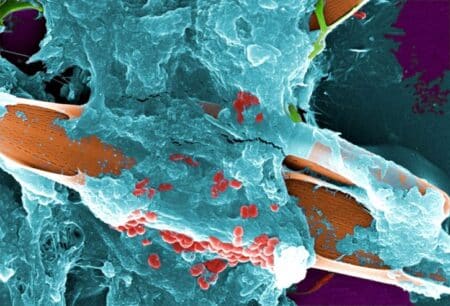 Ces micro-organismes qui colonisent votre habitat