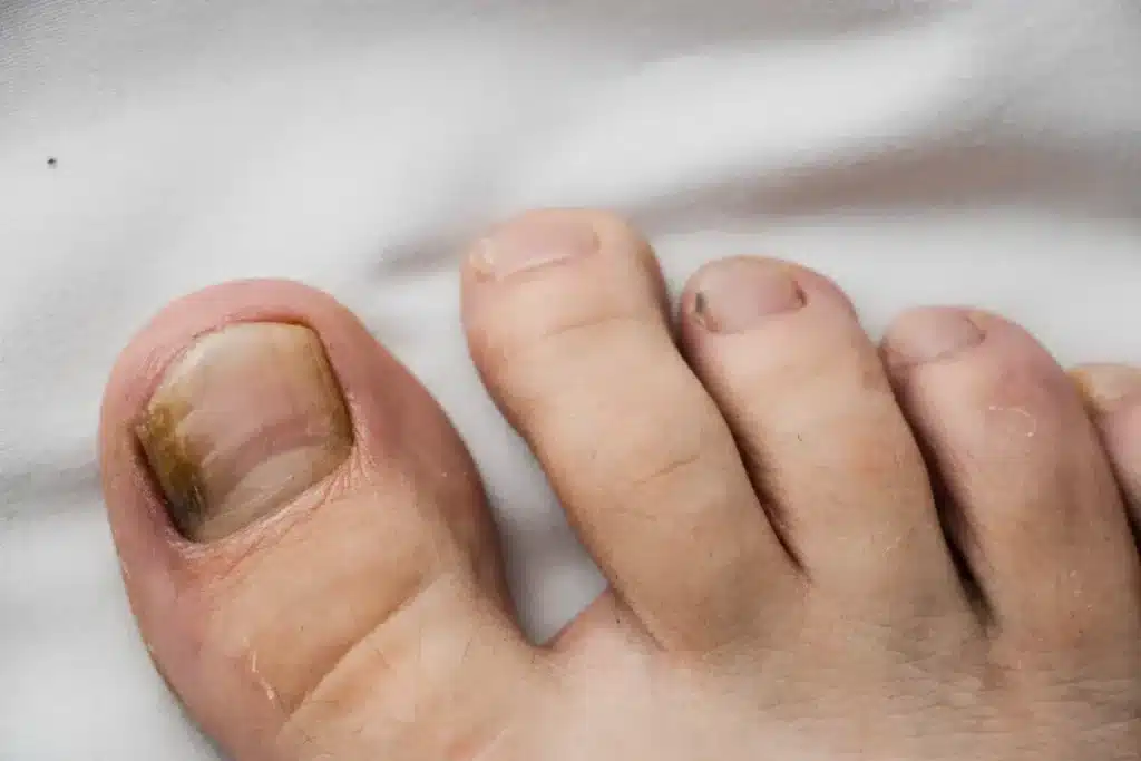 Pourquoi vos ongles ont ces petites lignes verticales : un dermatologue explique ce que votre corps essaie de vous dire depuis des années
