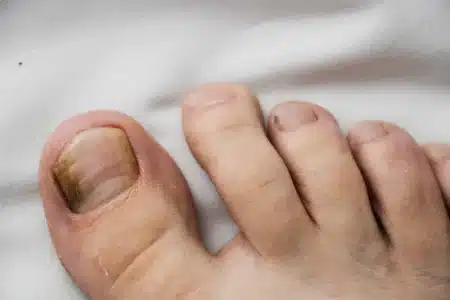 Pourquoi vos ongles ont ces petites lignes verticales : un dermatologue explique ce que votre corps essaie de vous dire depuis des années